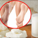 फटी एड़ियों की समस्या से क्या आप भी हैं परेशान? मोमबत्ती से बना ये घरेलू नुस्खा है बेहद असरदार, फॉलो करें ये टिप्स…