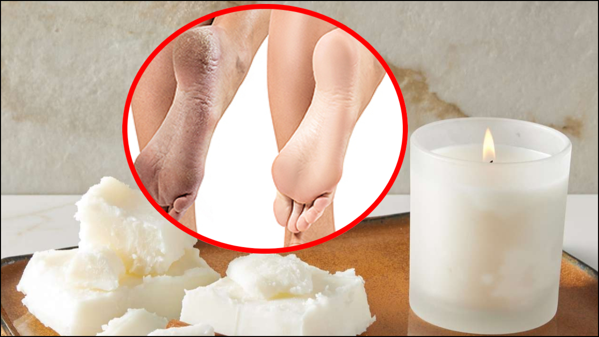 फटी एड़ियों की समस्या से क्या आप भी हैं परेशान? मोमबत्ती से बना ये घरेलू नुस्खा है बेहद असरदार, फॉलो करें ये टिप्स…